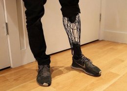Designer cria prótese mais leve e mais barata que as convencionais usando impressora 3D.