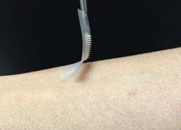 Adesivo inteligente controla nível de glicose em pacientes diabéticos.