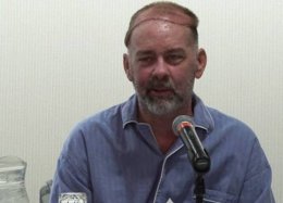 Homem recebe 1º transplante parcial de crânio do mundo.